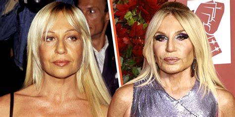 donatella versace real face.